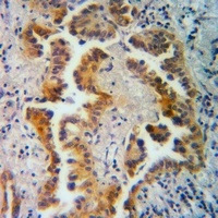 Anti-Neuromedin B Antibody