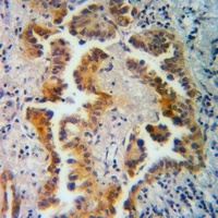 NMB antibody