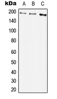 PDGFR beta (Phospho-Y1009) Antibody