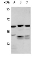 PKLR Antibody