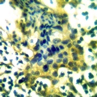 Anti-IPP1 Antibody