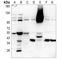 RBBP6 Antibody