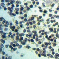 Anti-RBBP6 Antibody