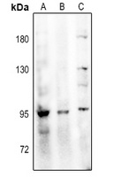 Anti-NHE5 Antibody