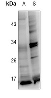Protachykinin 1 Rabbit Polyclonal Antibody