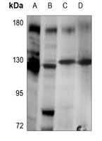 Telomerase Rabbit Polyclonal Antibody