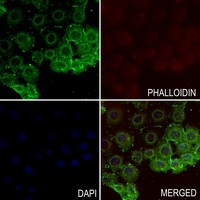 TRPV1 antibody