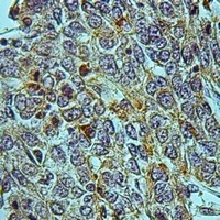 Anti-CREG1 Antibody