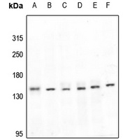 LATS1 Antibody