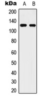 ULK2 Rabbit Polyclonal Antibody
