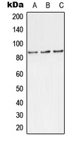 TLK1 (Phospho-S743) Antibody