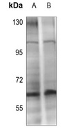 CHK2 (Phospho-T432) Antibody