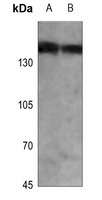 PHLPP Rabbit Polyclonal Antibody