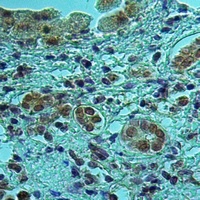 Anti-UBR2 Antibody
