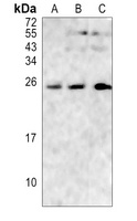 RGS17 Rabbit Polyclonal Antibody