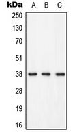 LAT (Phospho-Y255) Antibody