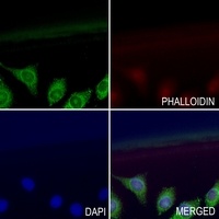 Anti-SERP1 Antibody