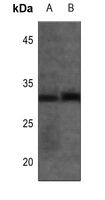CALY Antibody