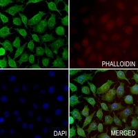 Anti-MED9 Antibody