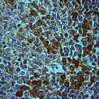 Anti-STK31 Antibody