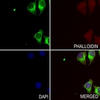 Anti-Resistin Antibody