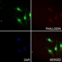 Anti-USP35 Antibody