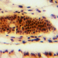 Anti-MOB2 Antibody