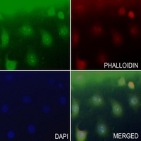 Anti-NAV3 Antibody