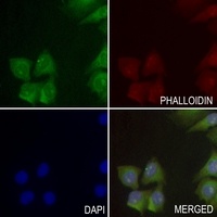Anti-ACER1 Antibody