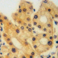 Anti-Agrin Antibody