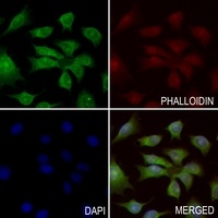 Anti-Agrin Antibody