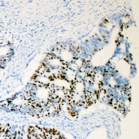 Anti-Androgen Receptor (Phospho-S650) Antibody