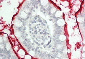 Anti-Defensin beta 2 Antibody