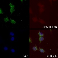 Anti-Defensin beta 2 Antibody
