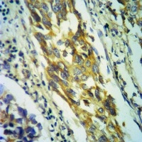 IFNA1 antibody