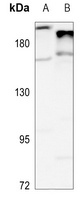 Complement C4A/B Antibody