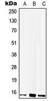 WIT1 Rabbit Polyclonal Antibody