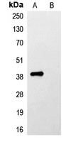 FLAG-tag Antibody