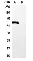 His-tag Antibody