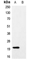 Myc-tag Antibody