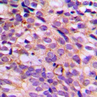 Anti-SGK223 (Phospho-Y413) Antibody