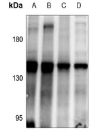 ABL1 Antibody