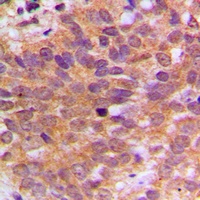 ABL1 Antibody