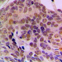 Anti-ADAR1 Antibody
