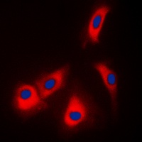 Adenosine Kinase Rabbit Polyclonal Antibody