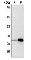 Adrenomedullin Antibody
