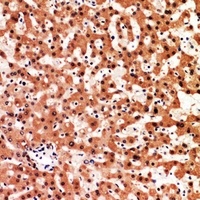 Anti-Adrenomedullin Antibody