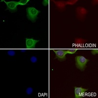 Anti-Adrenomedullin Antibody