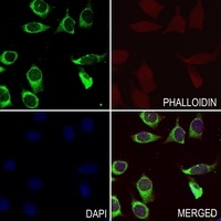Anti-Beta-2 Adrenergic Receptor Antibody