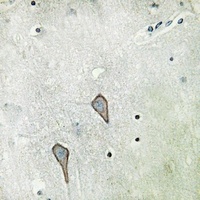 Anti-Beta-2 Adrenergic Receptor Antibody